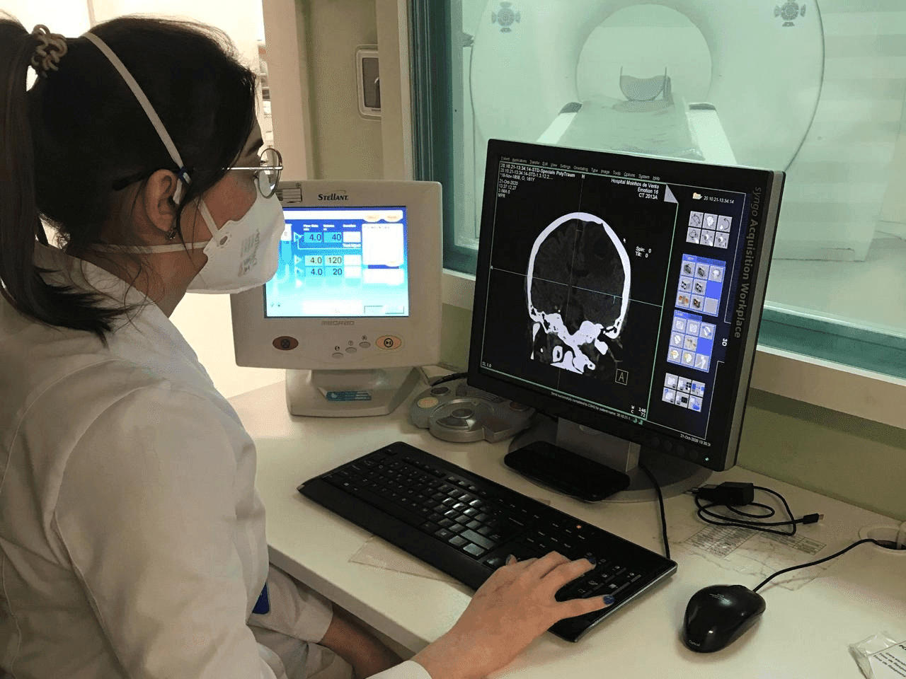 Estudo nacional testa primeira polipílula brasileira para prevenir AVC